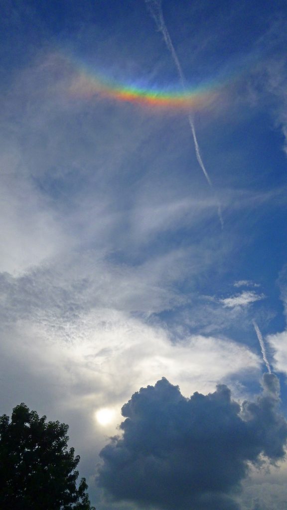 Arco circuncenital desde Texas, Estados Unidos