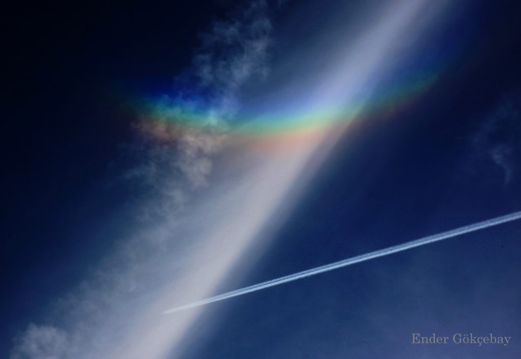 Arco circuncenital captado en Lovaina, Bélgica